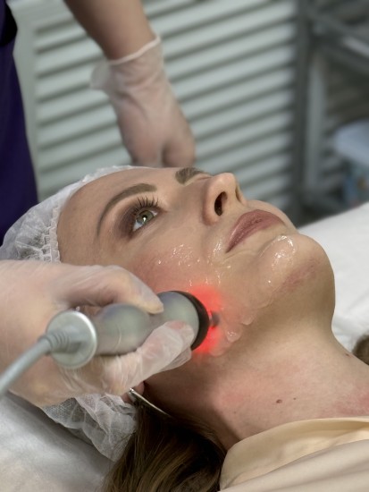 РФ- лифтинг